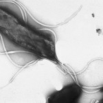 Bacteria Helico Pylori